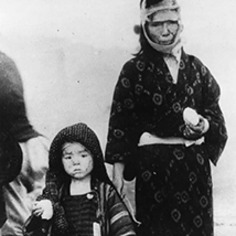 Überlebende: Mutter und Sohn in Nagasaki, August 1945